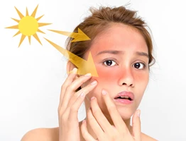 Sun Sensitivity