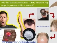 Mengapa DHT Menjadi Sasaran Utama dalam Penyelidikan Prostat Dan Rambut